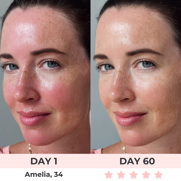 Villanetta™ - LED Face Mask